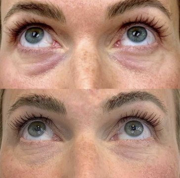 RitualCare Reviews: ervaringen, resultaten en veelgestelde vragen